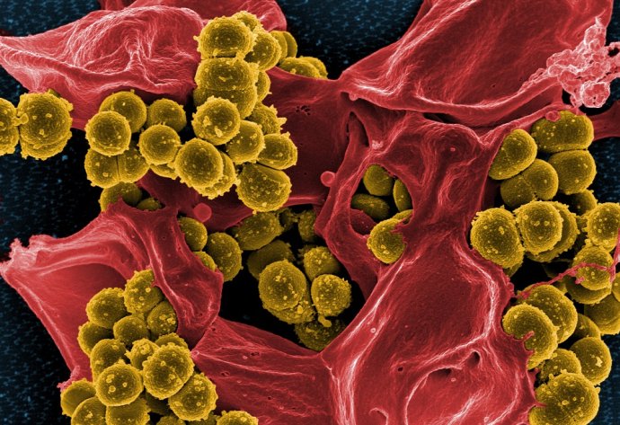 Micrograph of Methicillin-Resistant Staphylococcus aureus (MRSA) © NIAID
