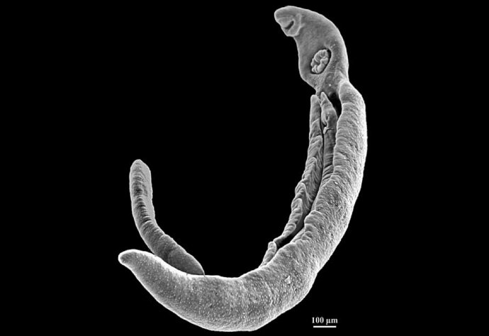 Schistosomiasis parasite photo: Smithonian Institute 