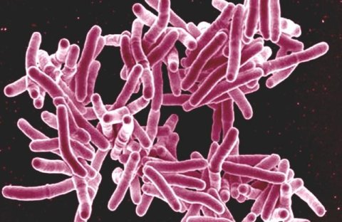 Tuberculosis bacteria Tuberculosis bacteria