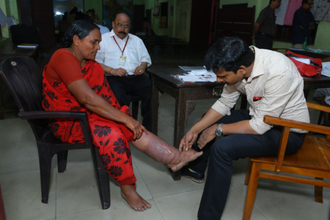 Filariasis - a lifetime burden that threatens livelihood Filariasis - a lifetime burden that threatens livelihood