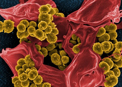 Micrograph of Methicillin-Resistant Staphylococcus aureus (MRSA) © NIAID Micrograph of Methicillin-Resistant Staphylococcus aureus (MRSA) © NIAID
