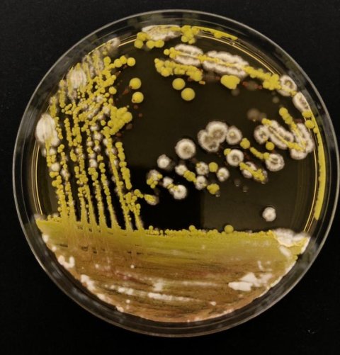 Different bacteria and fungi growing from a swab as part of the Swab and Send project. Photo credit; Ms Issra Bulgasim (LSTM)