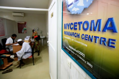 Mycetoma Research Centre in Sudan